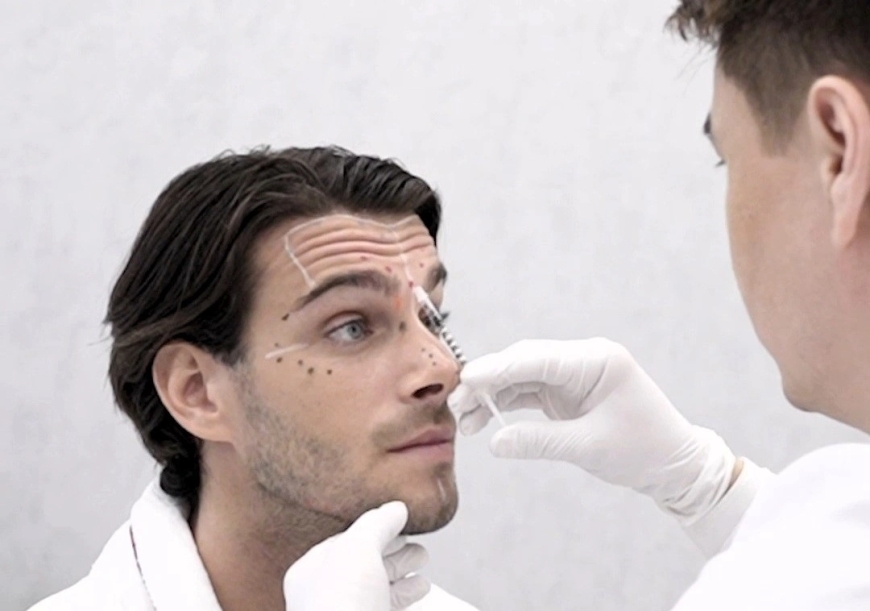 Botox Treatment in Dubai for Men: More Than Just an Anti-Aging Solution