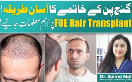 What Is FUE Hair Transplant? Complete Process Explained