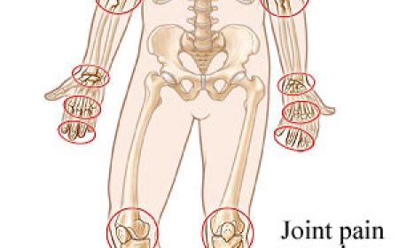 Relieving Cold & Flu Symptoms with Brufen 400 mg: A Smart Symptom Relief Guide