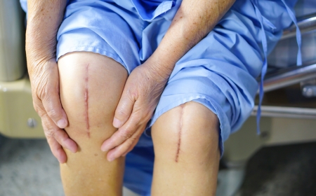 From Pain to Recovery: Best Knee Replacement Surgeons in Jaipur