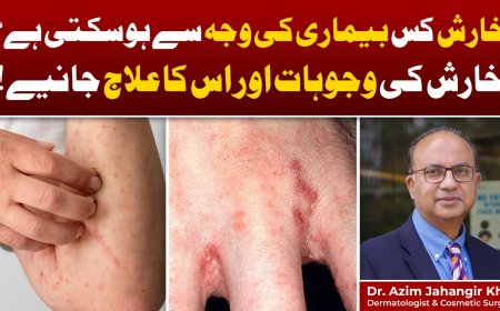 Itchy Skin: Simple Reasons and When to See a Doctor