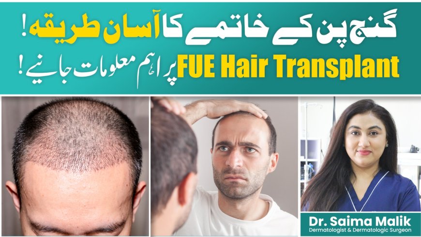What Is FUE Hair Transplant? Complete Process Explained