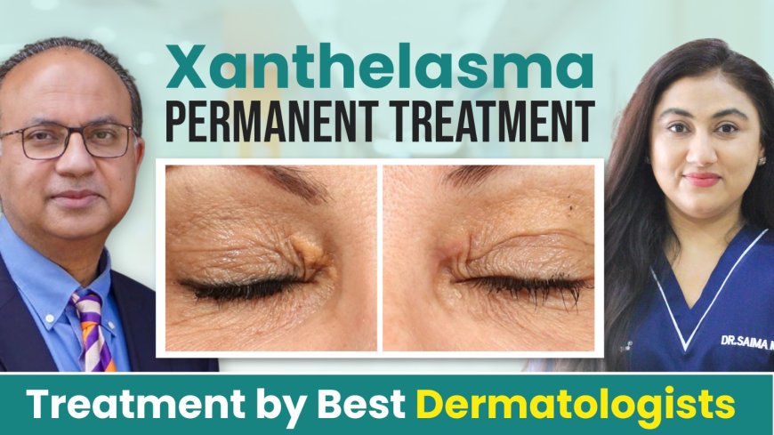 Expert Dermatologist for Xanthelasma | Get Clear Skin Today