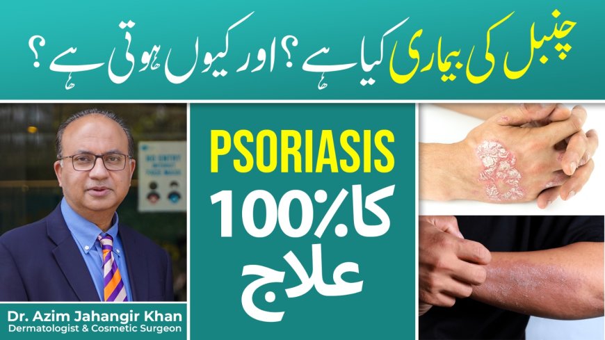 Psoriasis Care by Top Skin Doctors in Lahore