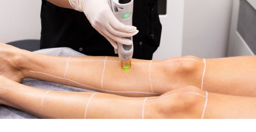 Why Laser Hair Removal is the Best Choice for Long-Term Smooth Skin